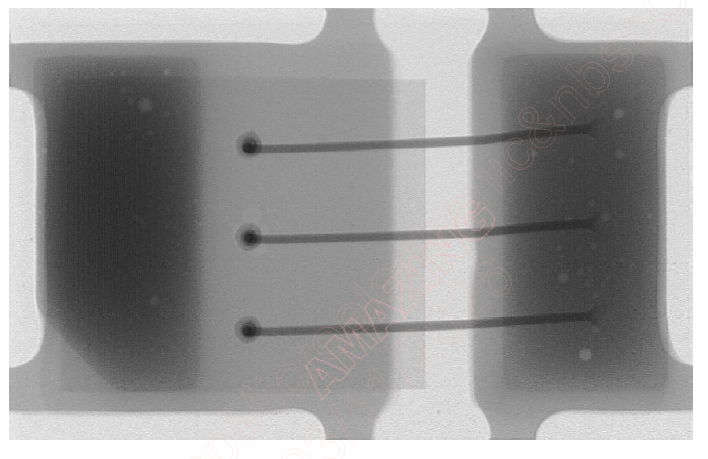 Figure 5. X-ray Image of TVS(b)