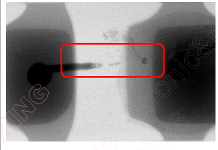 图4 TVS(a) X-ray照片